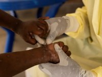 Saúde confirma primeiro caso de nova cepa de mpox no Brasil - Foto: Agência Brasil