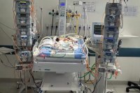 Gêmeas siamesas morrem uma semana após o nascimento - Foto: Reprodução Redes Sociais