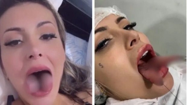 Adepta da modificação corporal, Urach já tirou costelas e tem um litro de silicone em cada seio (Foto: Reprodução internet)