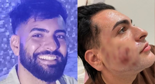 Câmeras de segurança da clínica de estética registraram desde a chegada da vítima até as tentativas de reanimaçã (Foto: Reprodução)