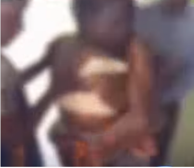 Casal confunde cola com lubrificante íntimo e acaba colado em sexo - VÍDEO