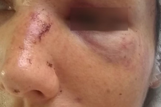 O acusado, que seria usuário de drogas, ficou furioso e investiu contra a mãe aplicando socos no rosto dela (Foto: Foto Meramente Ilustrativa)