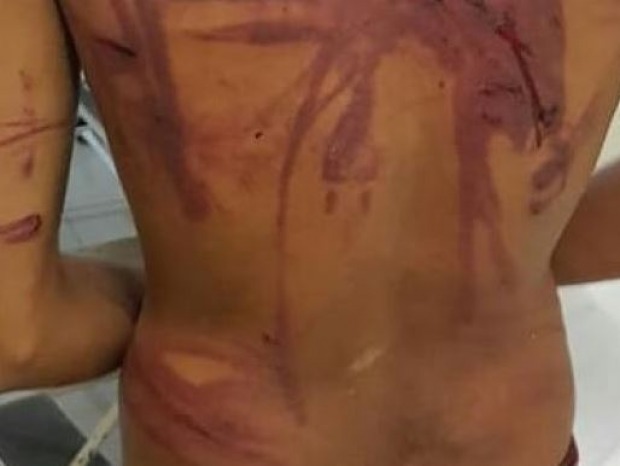  (Foto: Foto Meramente Ilustrativa)
