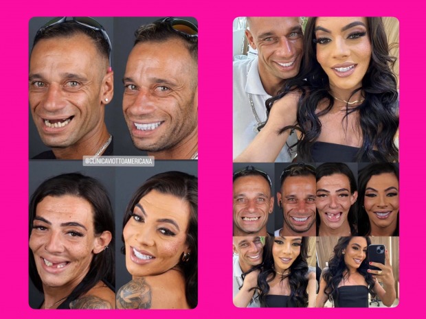Casal 'Maloka' celebra novo sorriso após ganhar tratamento (Foto: Reprodução Google)