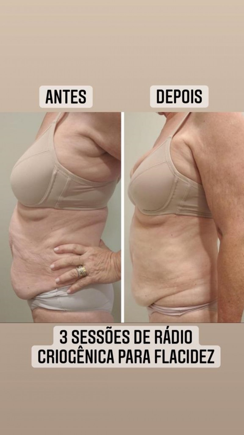 ReproduÃÂ§ÃÂ£o (Foto: ReproduÃÂ§ÃÂ£o)