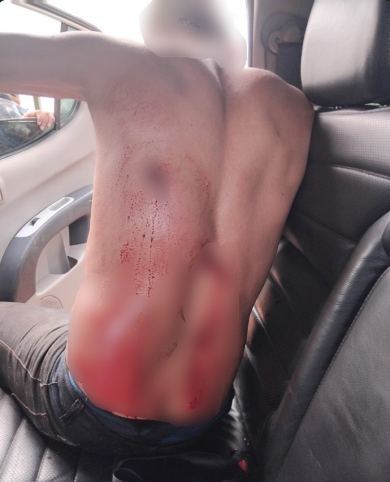 Homem ferido (Foto: Reprodução)