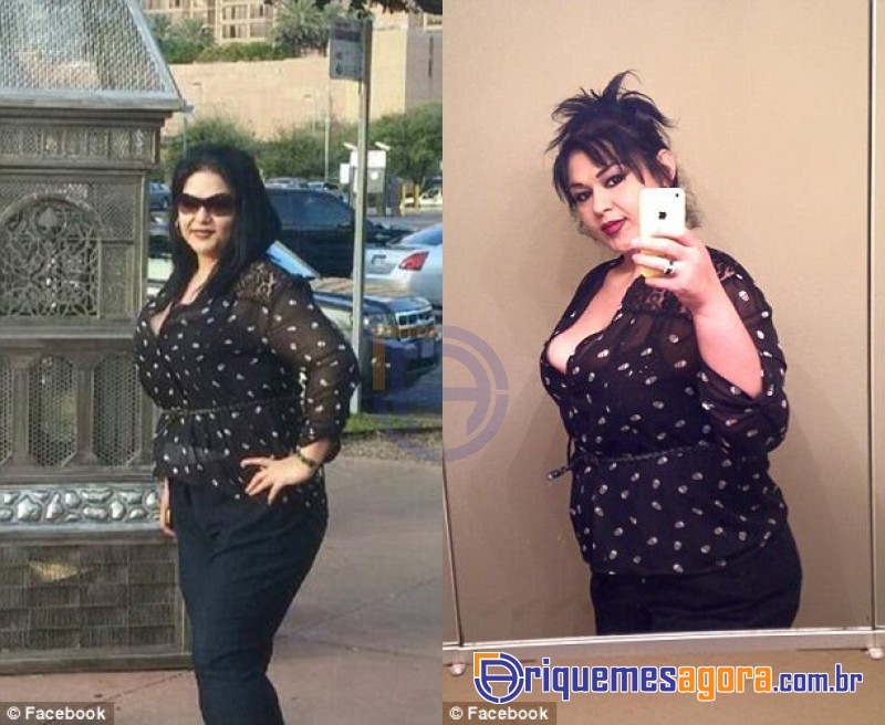 Mulher mais gorda do mundo perde 395 quilos