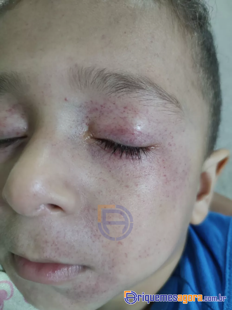 Criança de dois anos engasga com pipoca e é salva por policiais militares em Rondônia