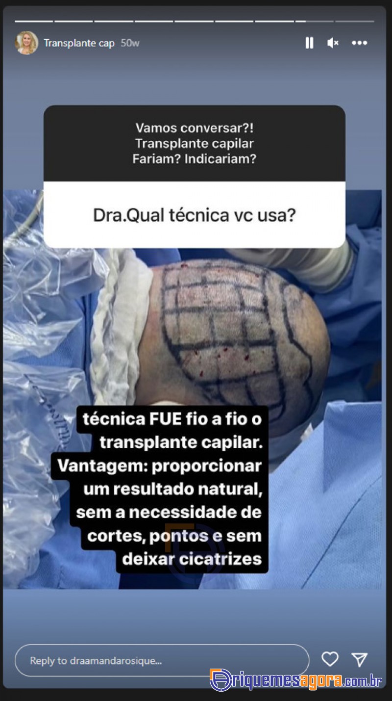 Residentes dos EUA procuram transplante capilar em Ariquemes