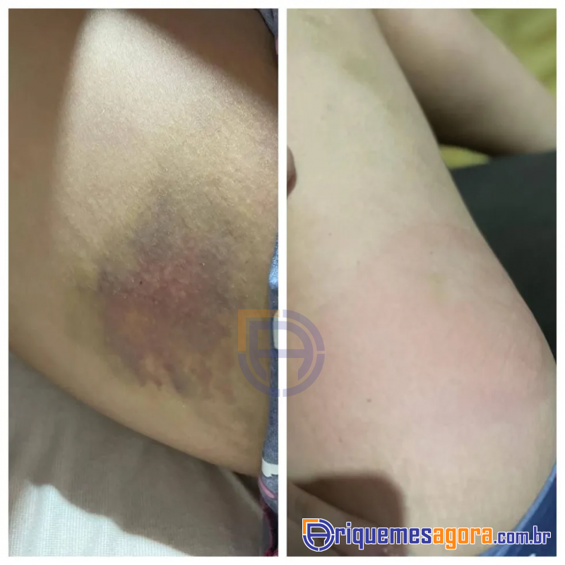 Ex-esposa de influencer diz que foi agredida por mais de um ano antes de denunciá-lo